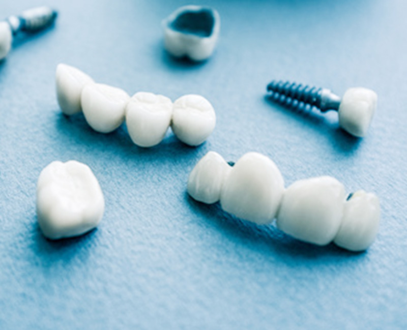 長く付き合える耐久性ある歯科素材