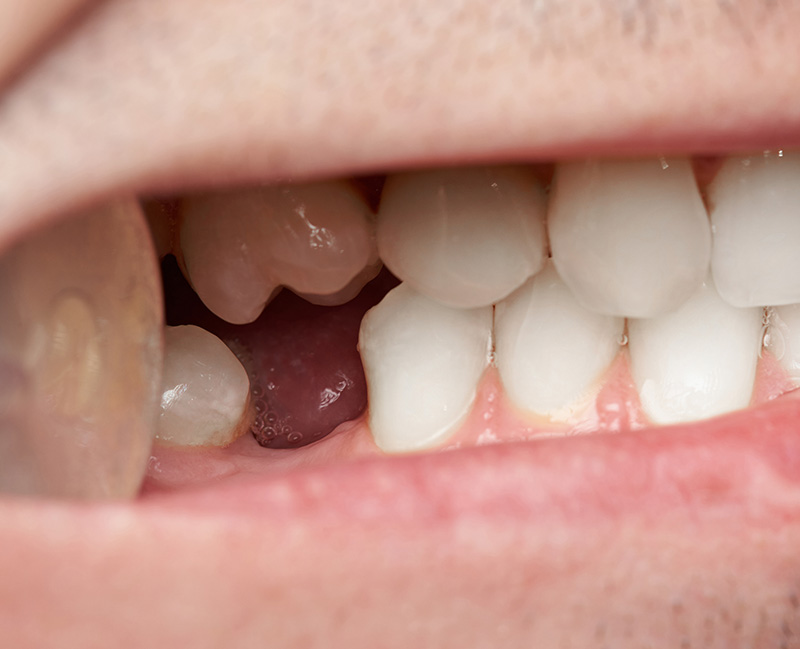 予防歯科と連携